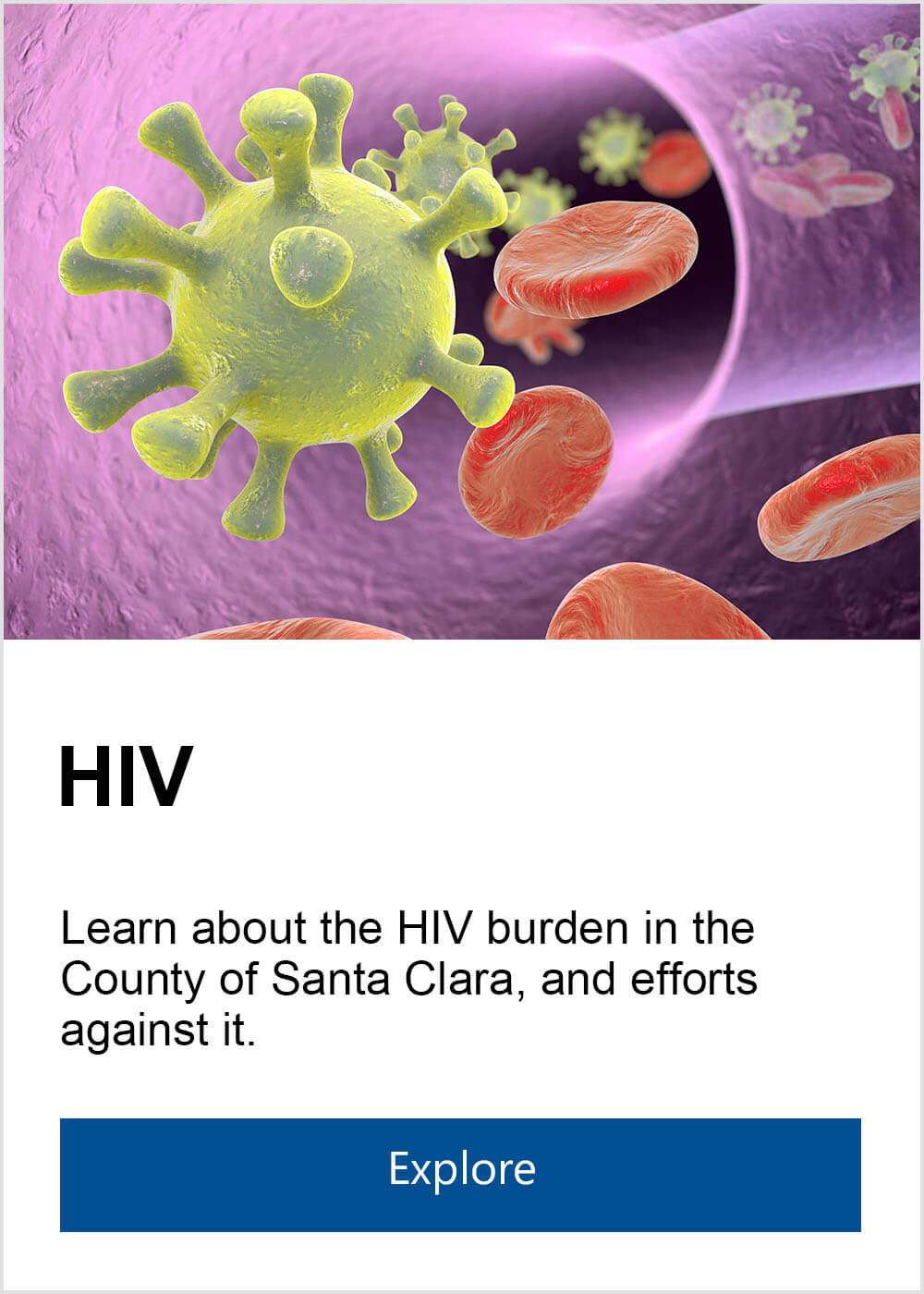 Learn about HIV burden in Santa Clara County and efforts to prevent it